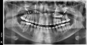 Los beneficios de la radiología digital