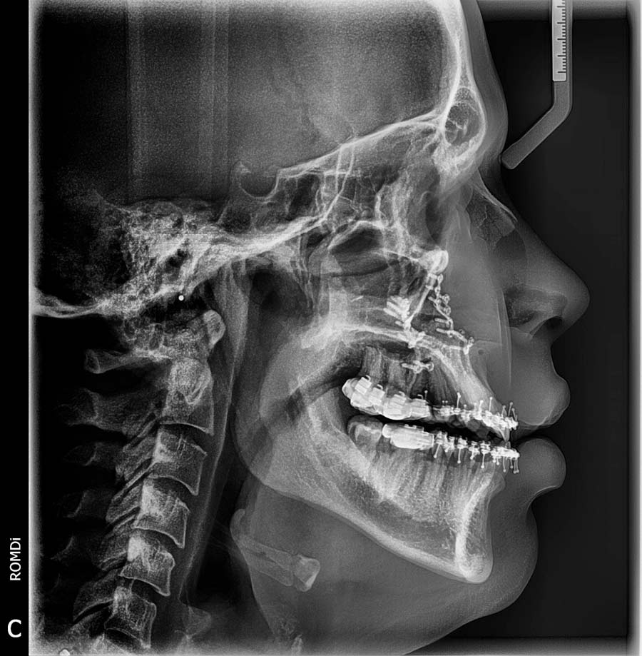 Los beneficios de la radiología digital - ROMDI